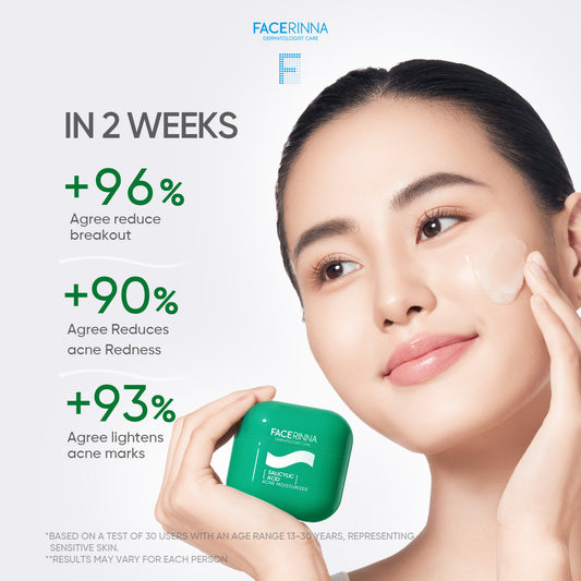 Salicylic Acid Acne Moisturizer