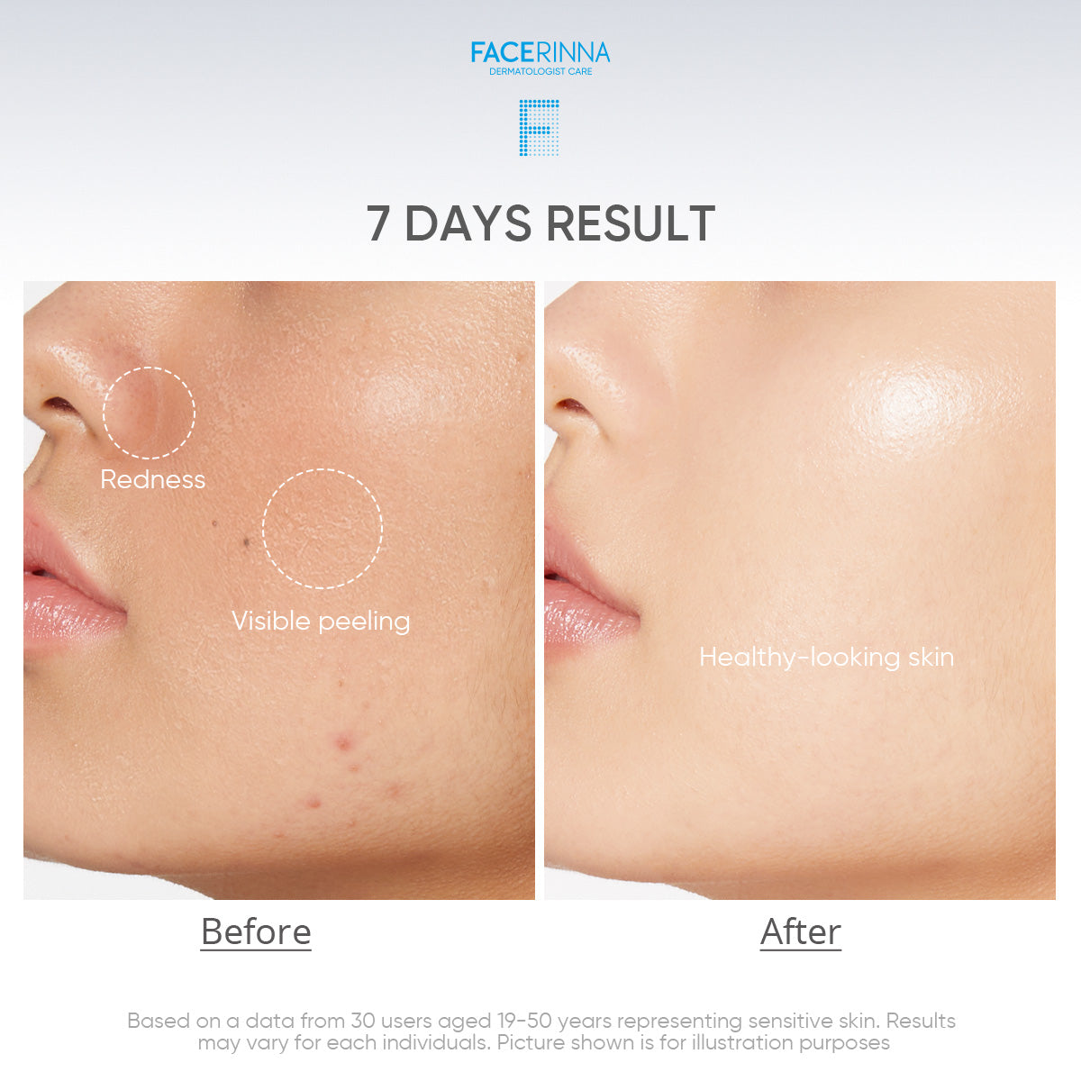Ceramide B5 Balancing Moisturizer