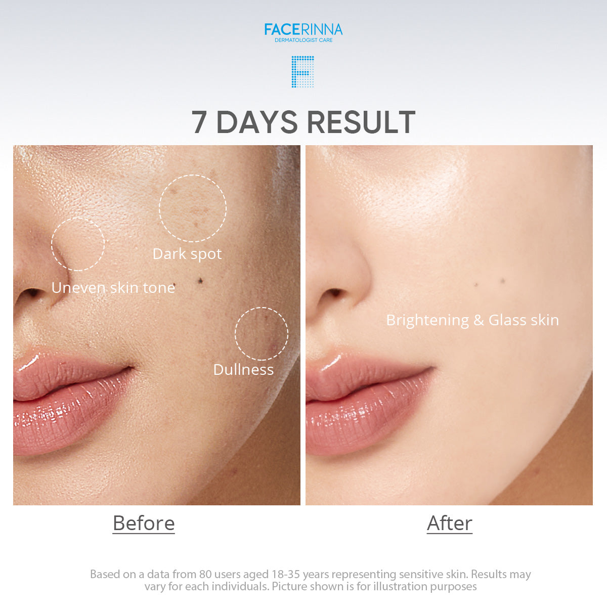 10% Niacinamide 3% TXA Bright Dark Spot Serum
