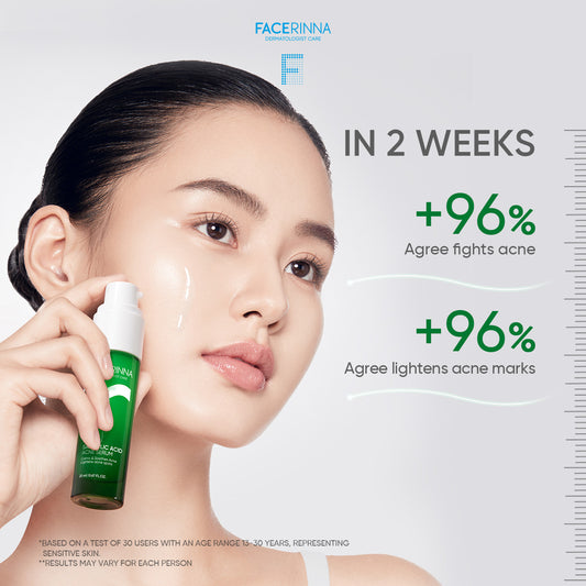 2% Salicylic Acid Acne Serum
