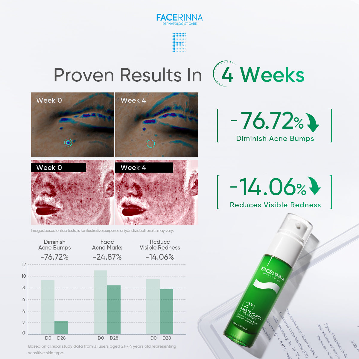 2% Salicylic Acid Acne Serum