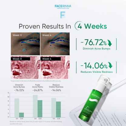2% Salicylic Acid Acne Serum