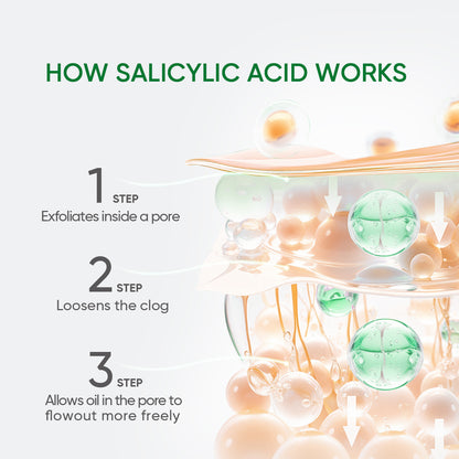 Salicylic Acid Acne Toner