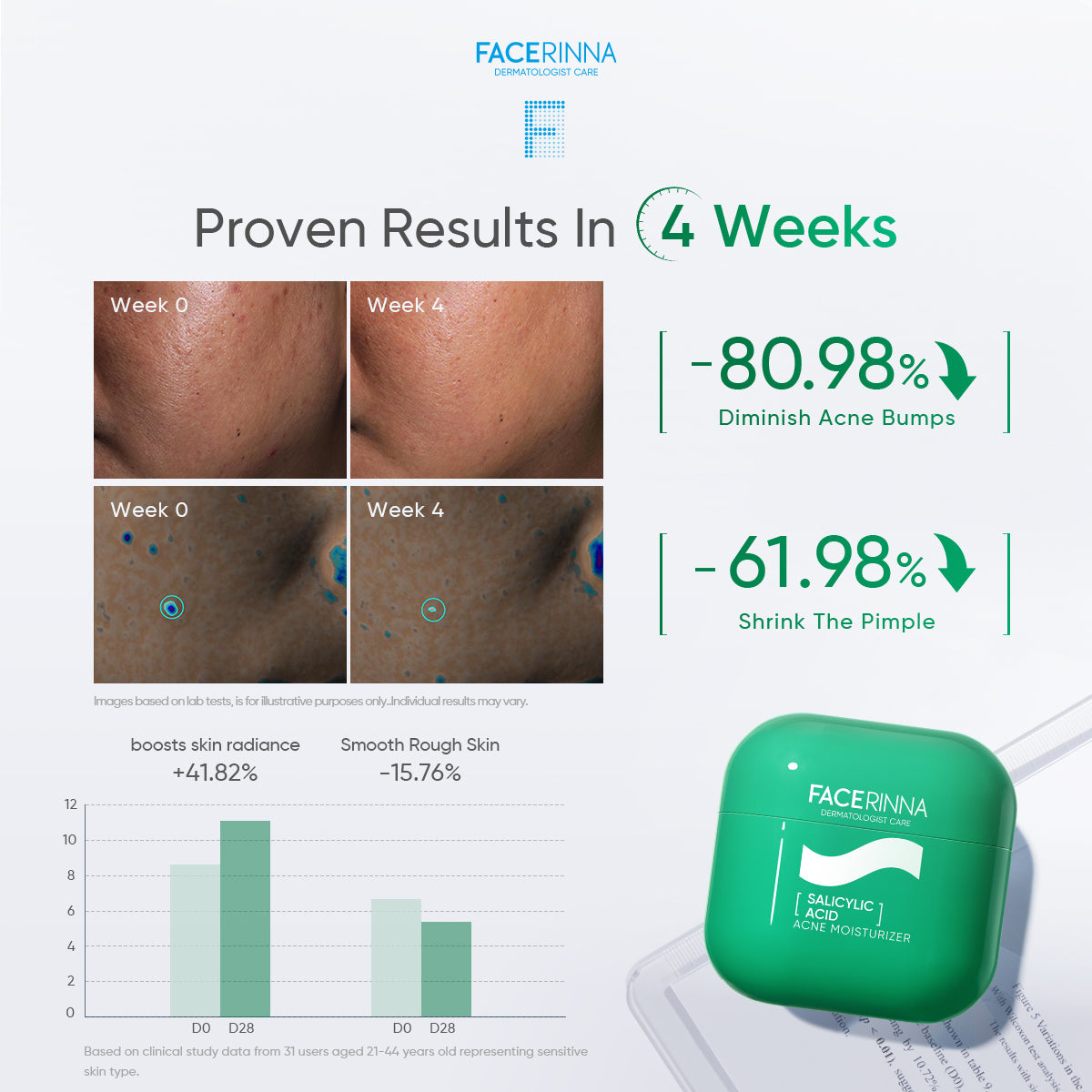Salicylic Acid Acne Moisturizer