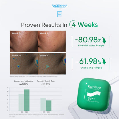 Salicylic Acid Acne Moisturizer
